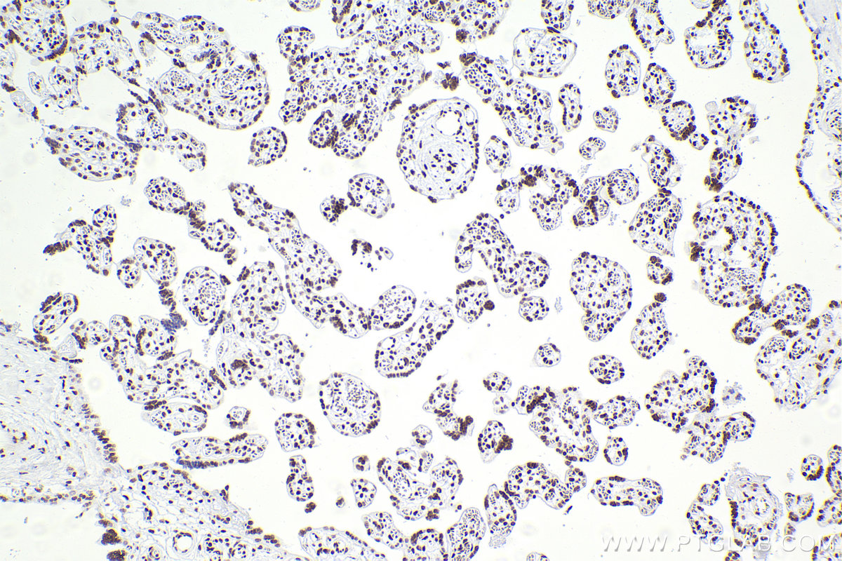 IHC staining of human placenta using 83310-2-RR