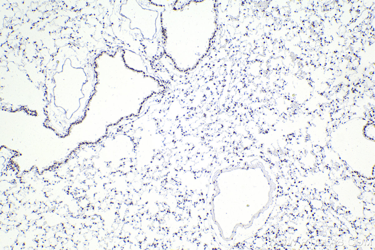 IHC staining of mouse lung using 83310-2-RR