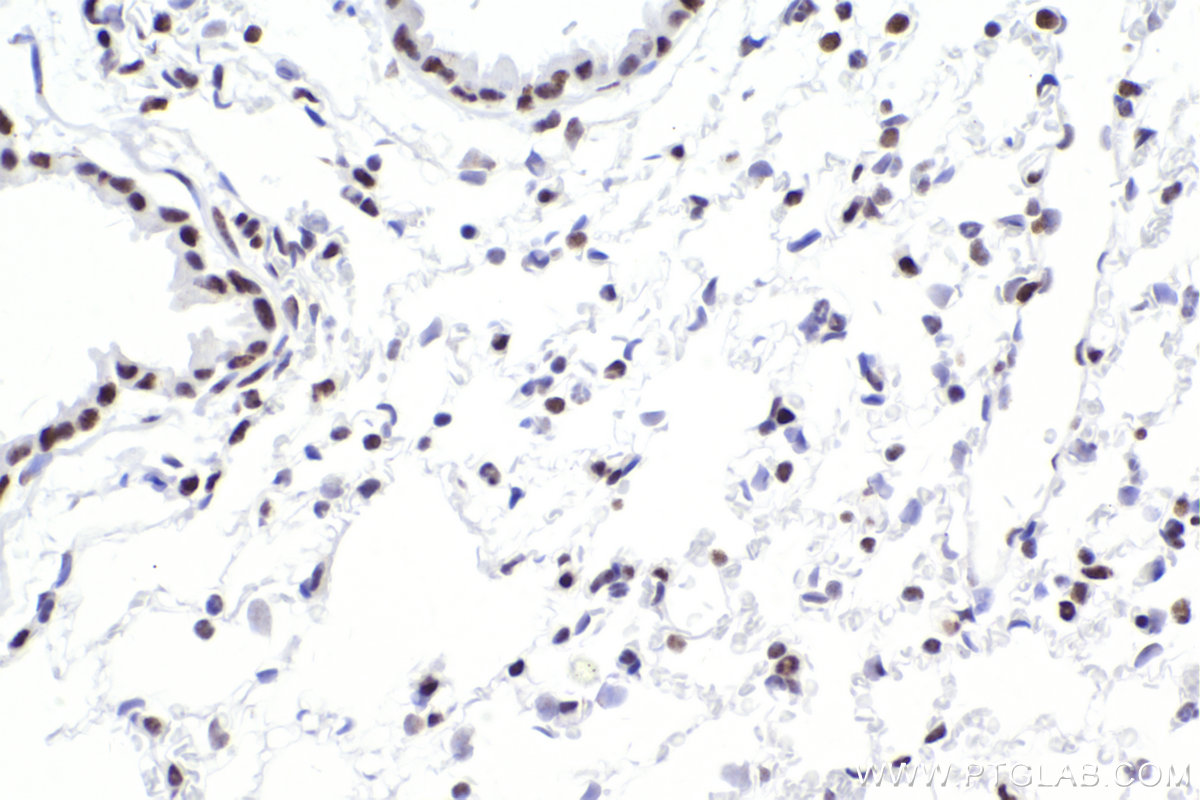 IHC staining of mouse lung using 83310-2-RR