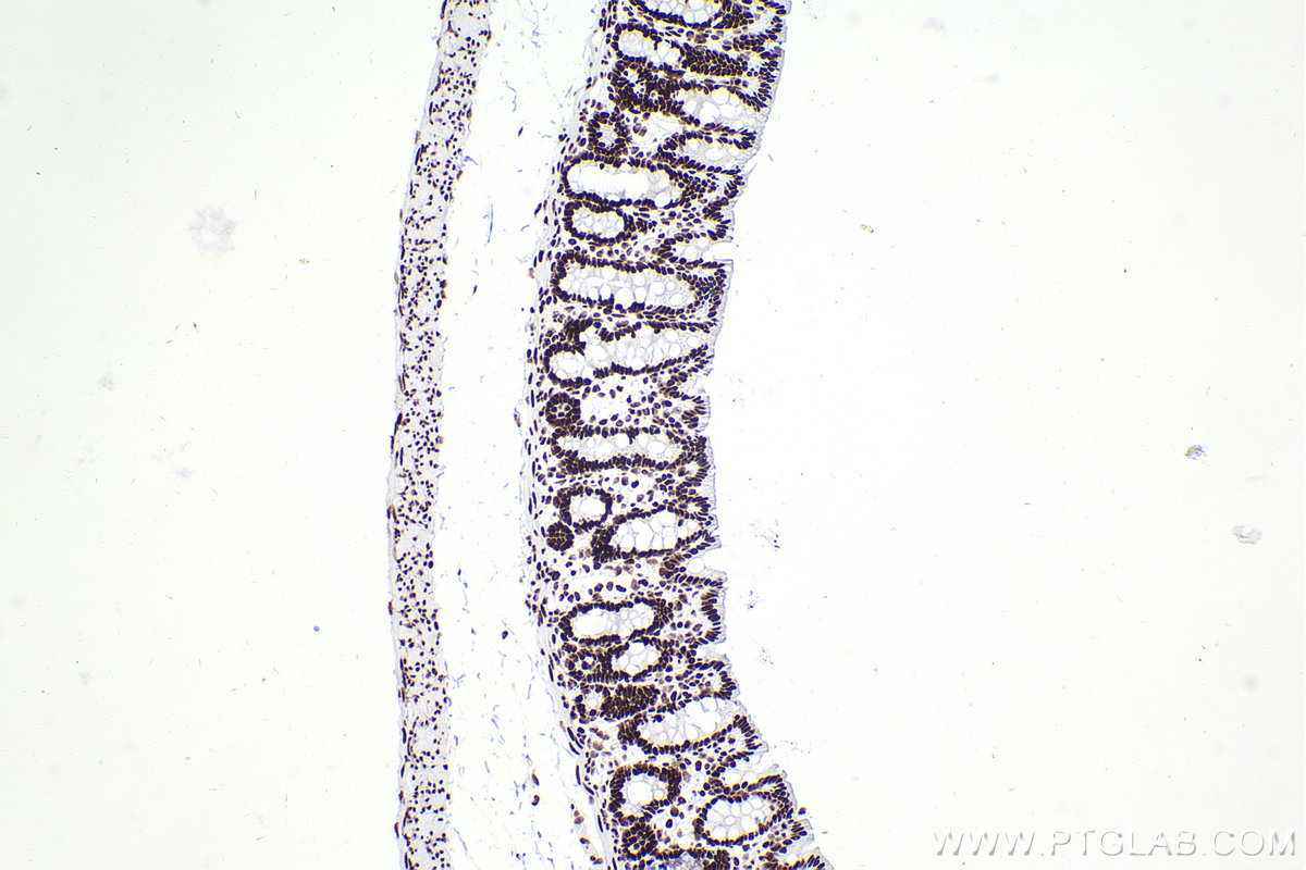 IHC staining of rat colon using 83310-2-RR