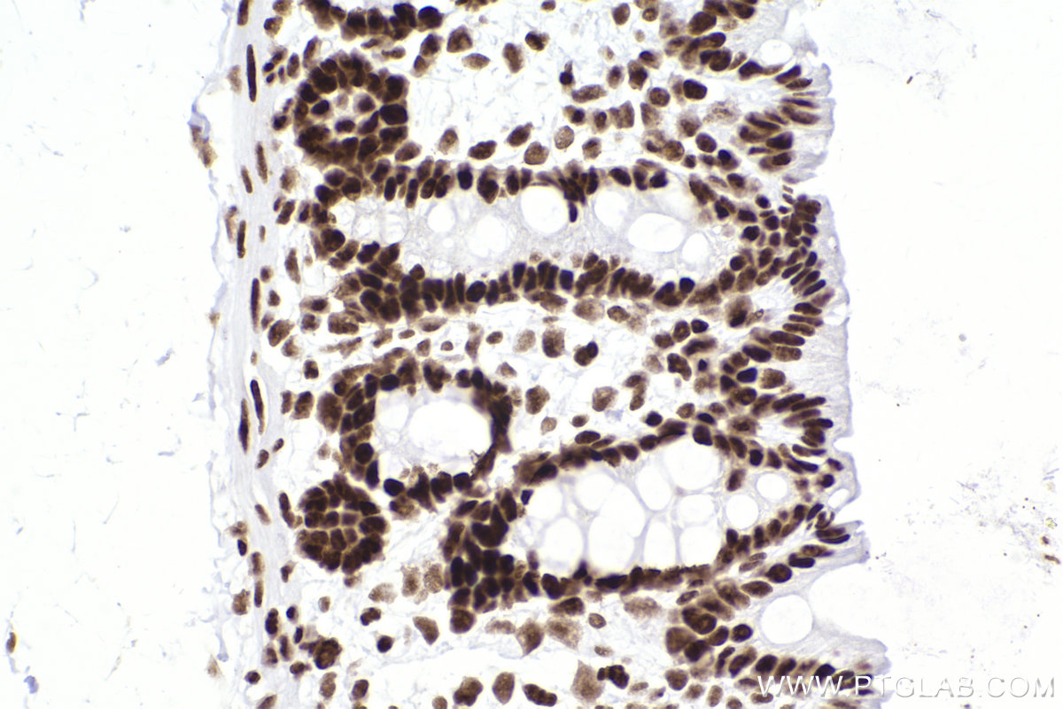 IHC staining of rat colon using 83310-2-RR