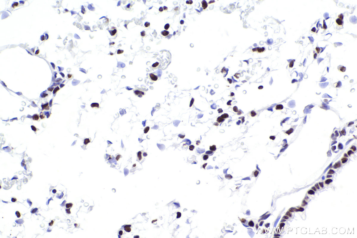 IHC staining of rat lung using 83310-2-RR