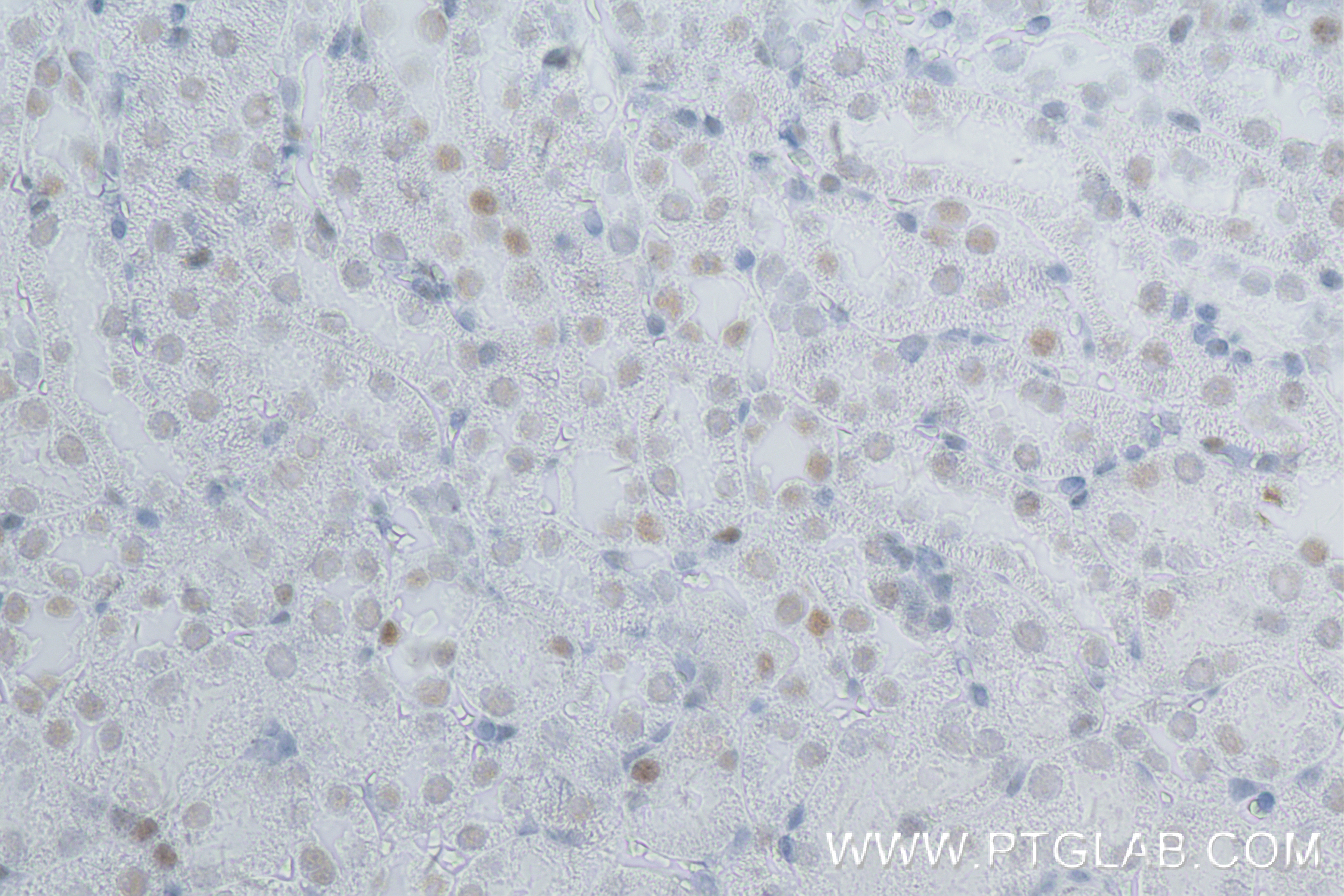 IHC staining of mouse kidney using 83310-7-RR (same clone as 83310-7-PBS)