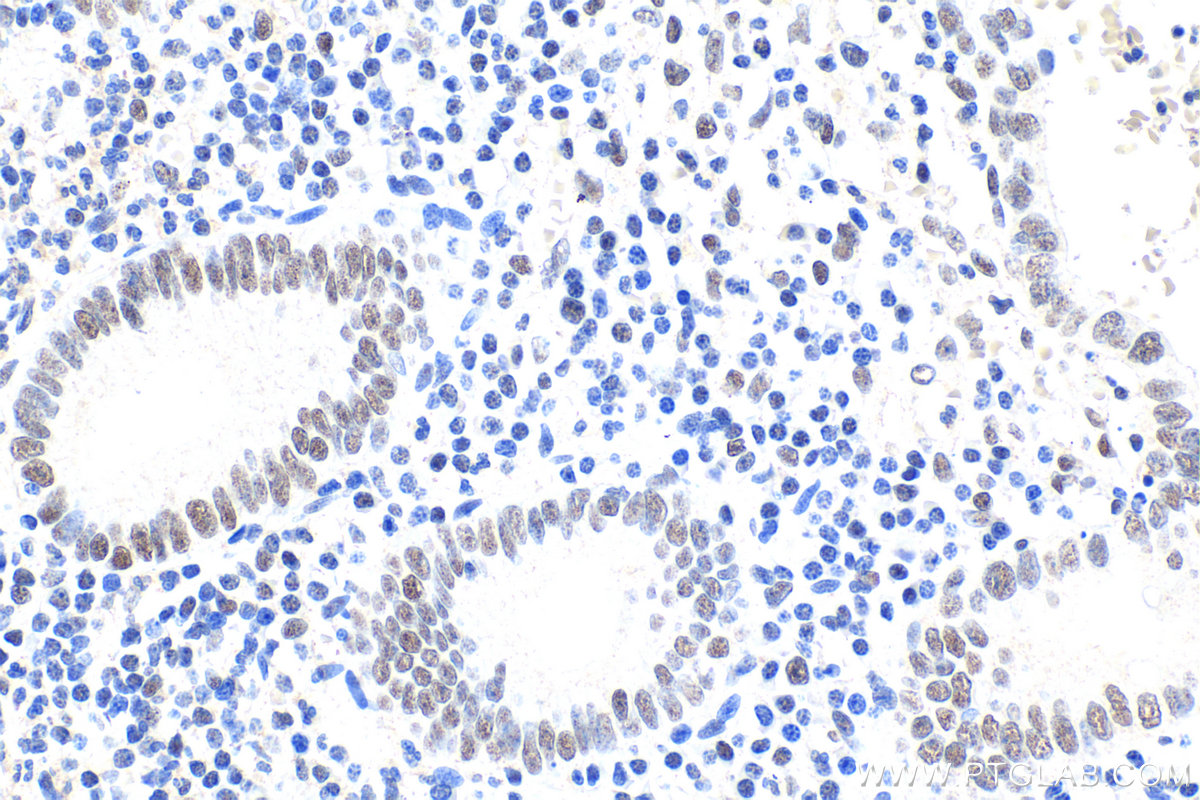 IHC staining of human appendicitis using 17722-1-AP