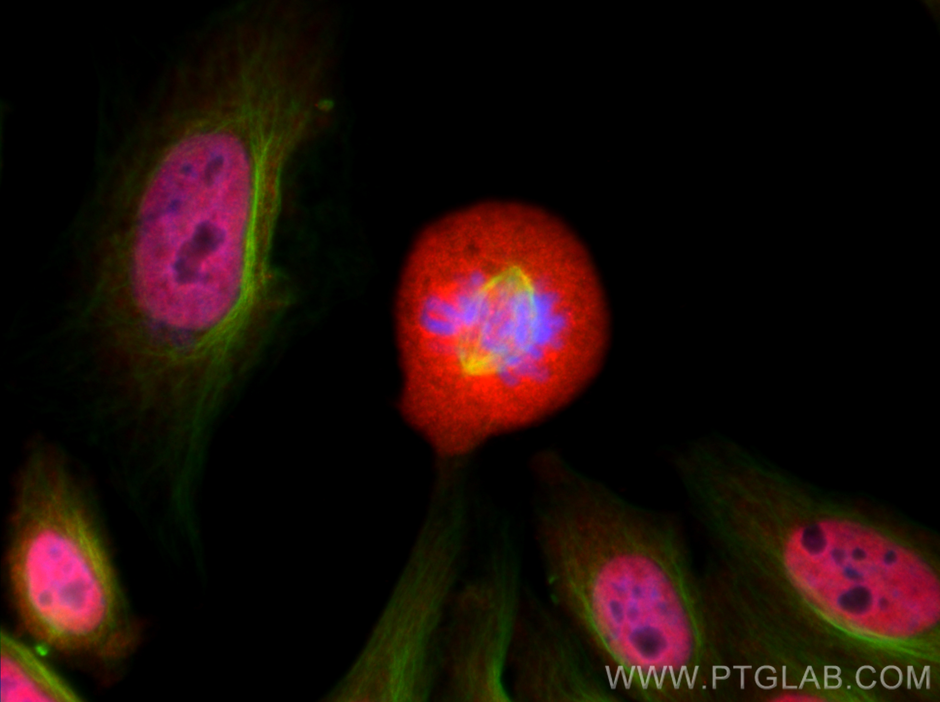 IF Staining of HepG2 using 12018-1-AP