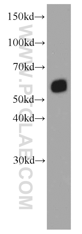 WB analysis of Jurkat using 66116-1-Ig (same clone as 66116-1-PBS)