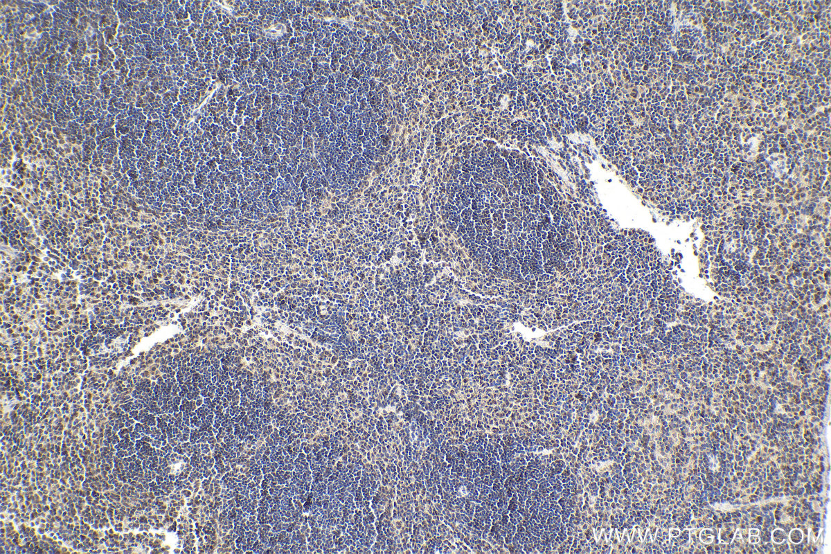 IHC staining of mouse spleen using 11156-1-AP