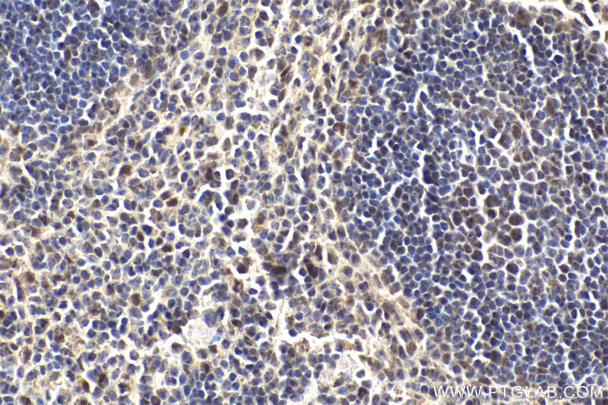 IHC staining of mouse spleen using 11156-1-AP