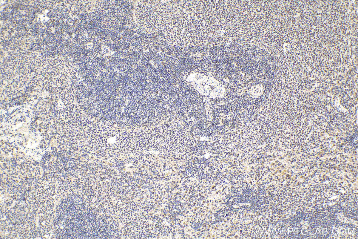 IHC staining of rat spleen using 11156-1-AP