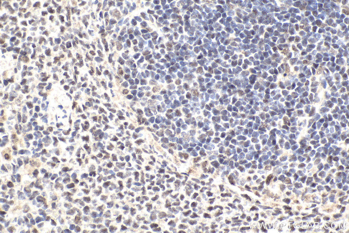 IHC staining of rat spleen using 11156-1-AP