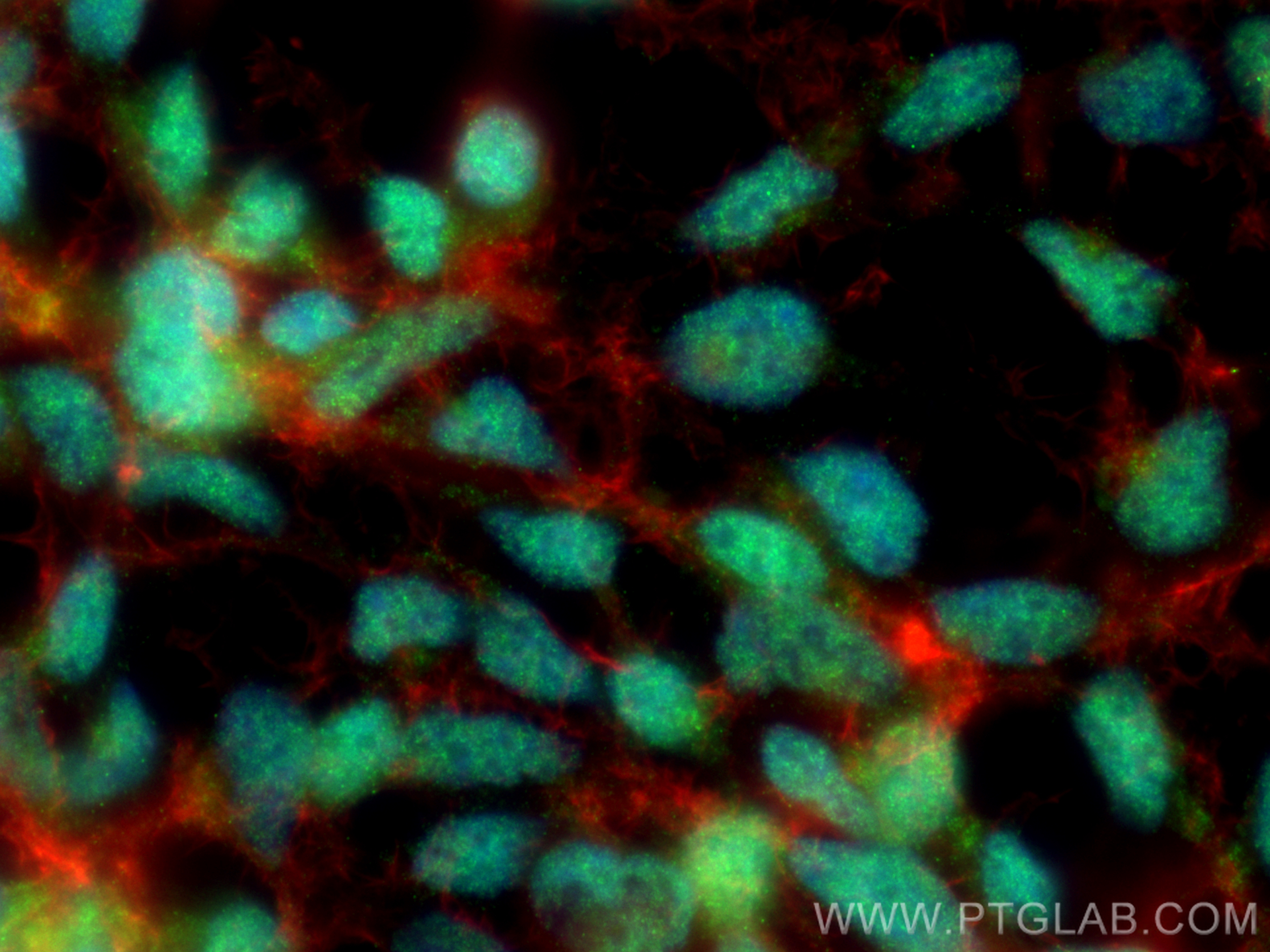 IF Staining of HEK-293 using 66182-1-Ig (same clone as 66182-1-PBS)