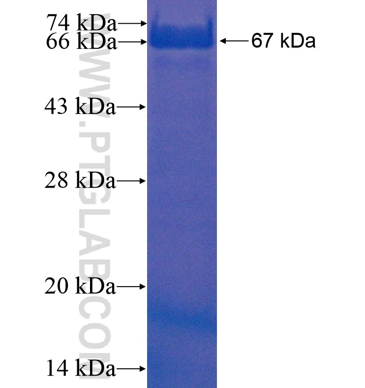 SMC1A fusion protein Ag16286 SDS-PAGE