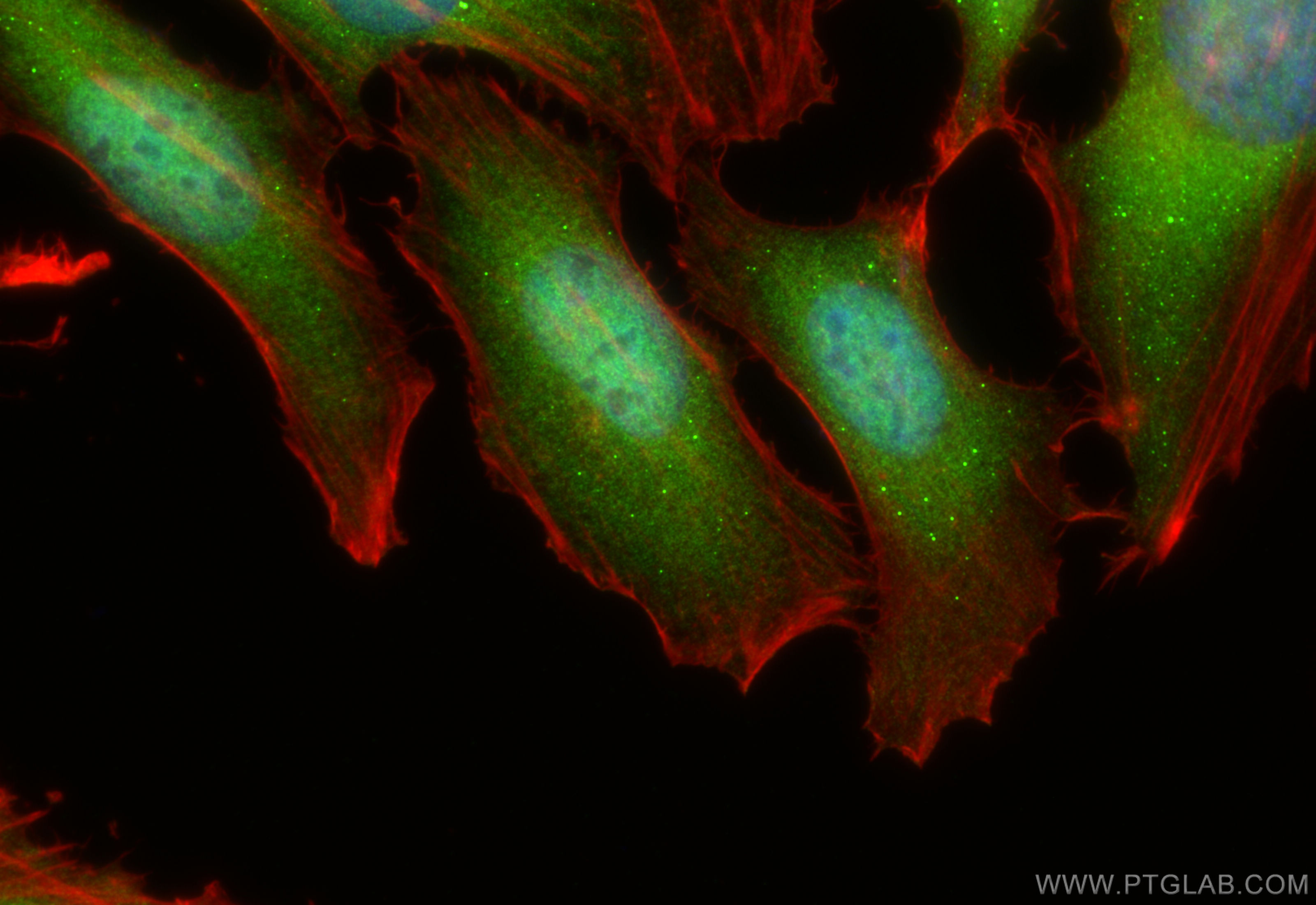 IF Staining of HeLa using 30707-1-AP