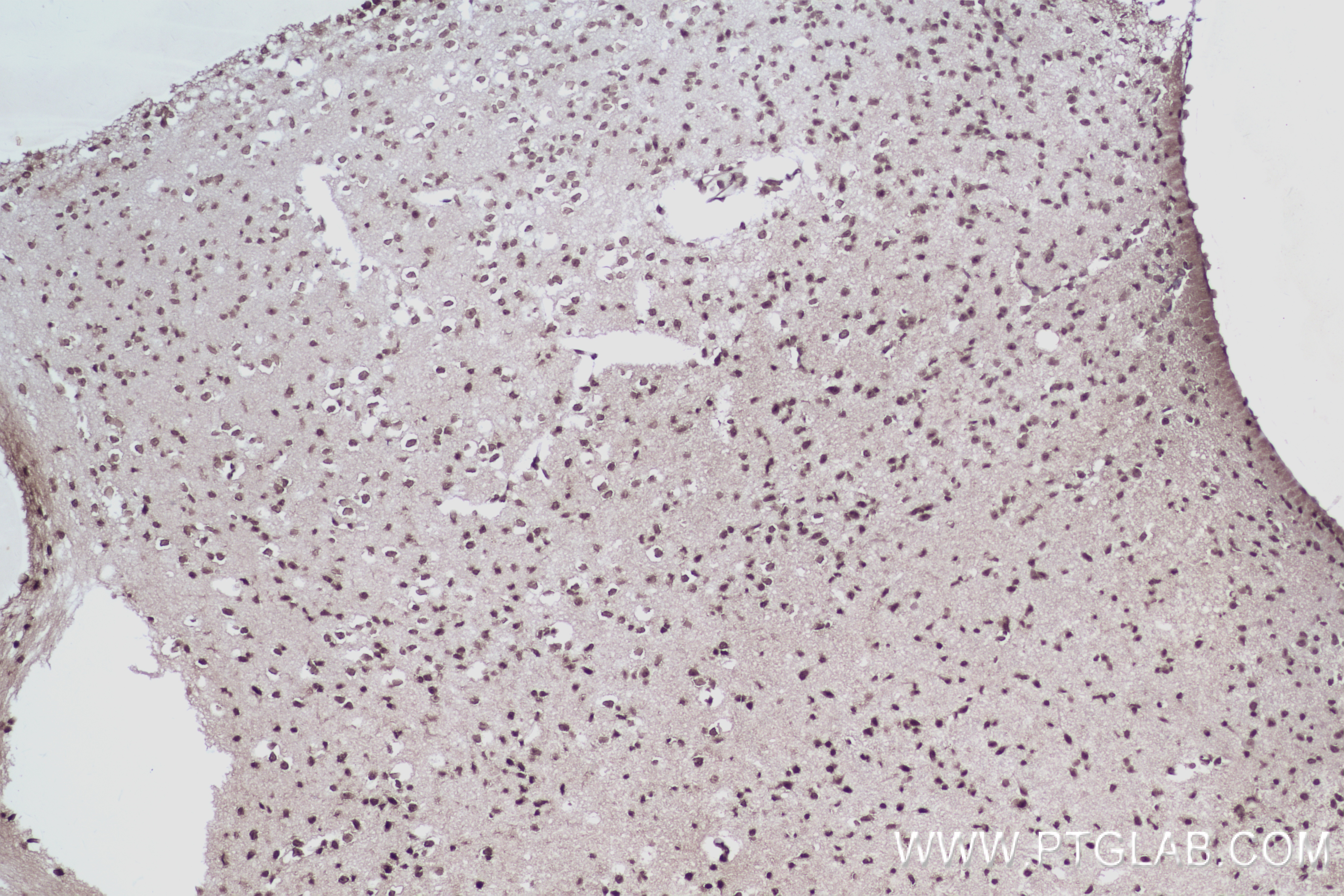 IHC staining of mouse brain using 84835-1-RR