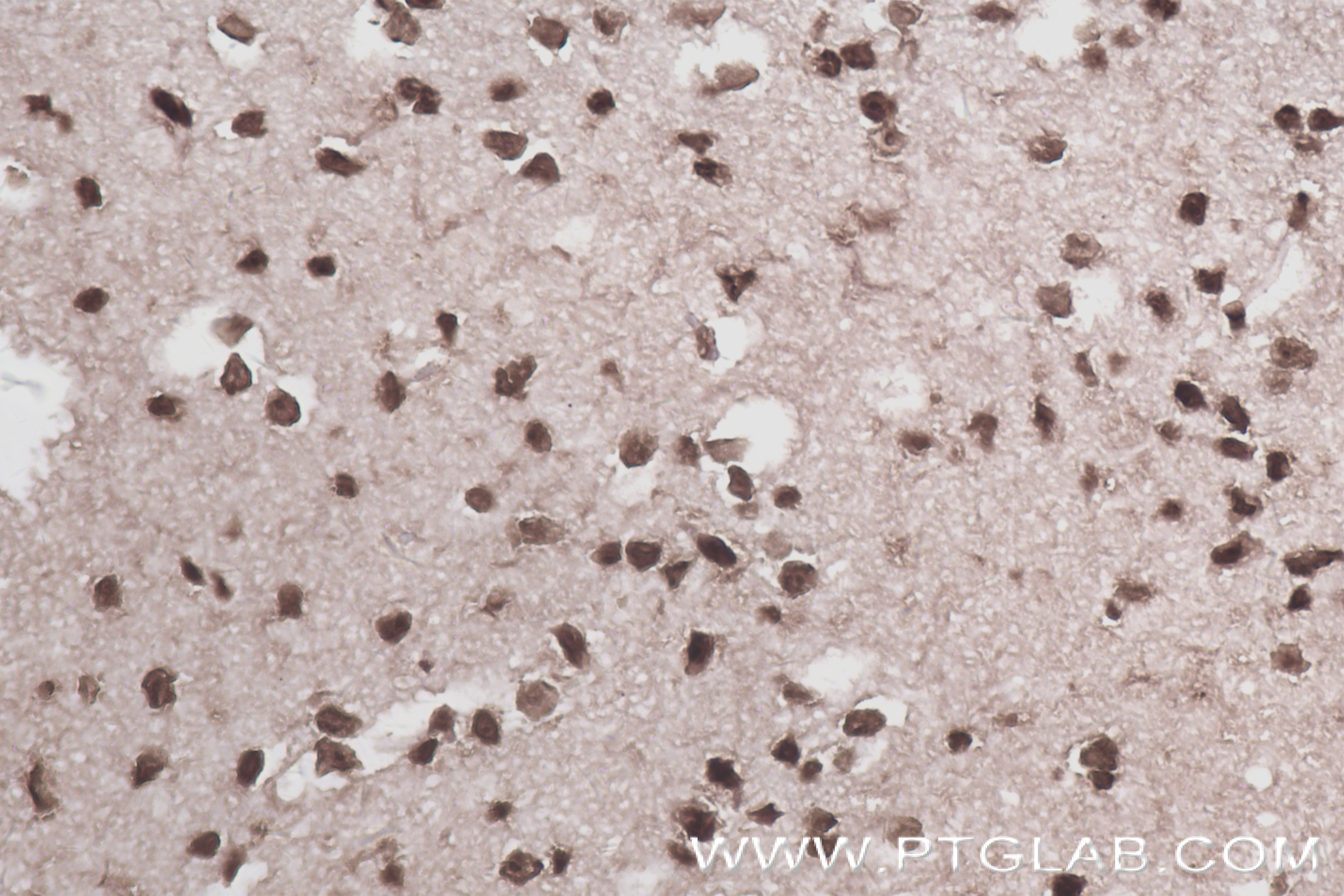 IHC staining of mouse brain using 84835-1-RR (same clone as 84835-1-PBS)