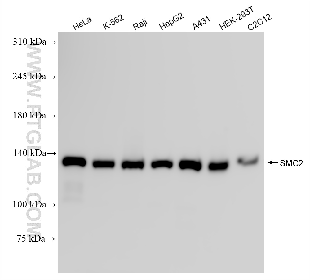 WB analysis using 84835-2-RR (same clone as 84835-2-PBS)