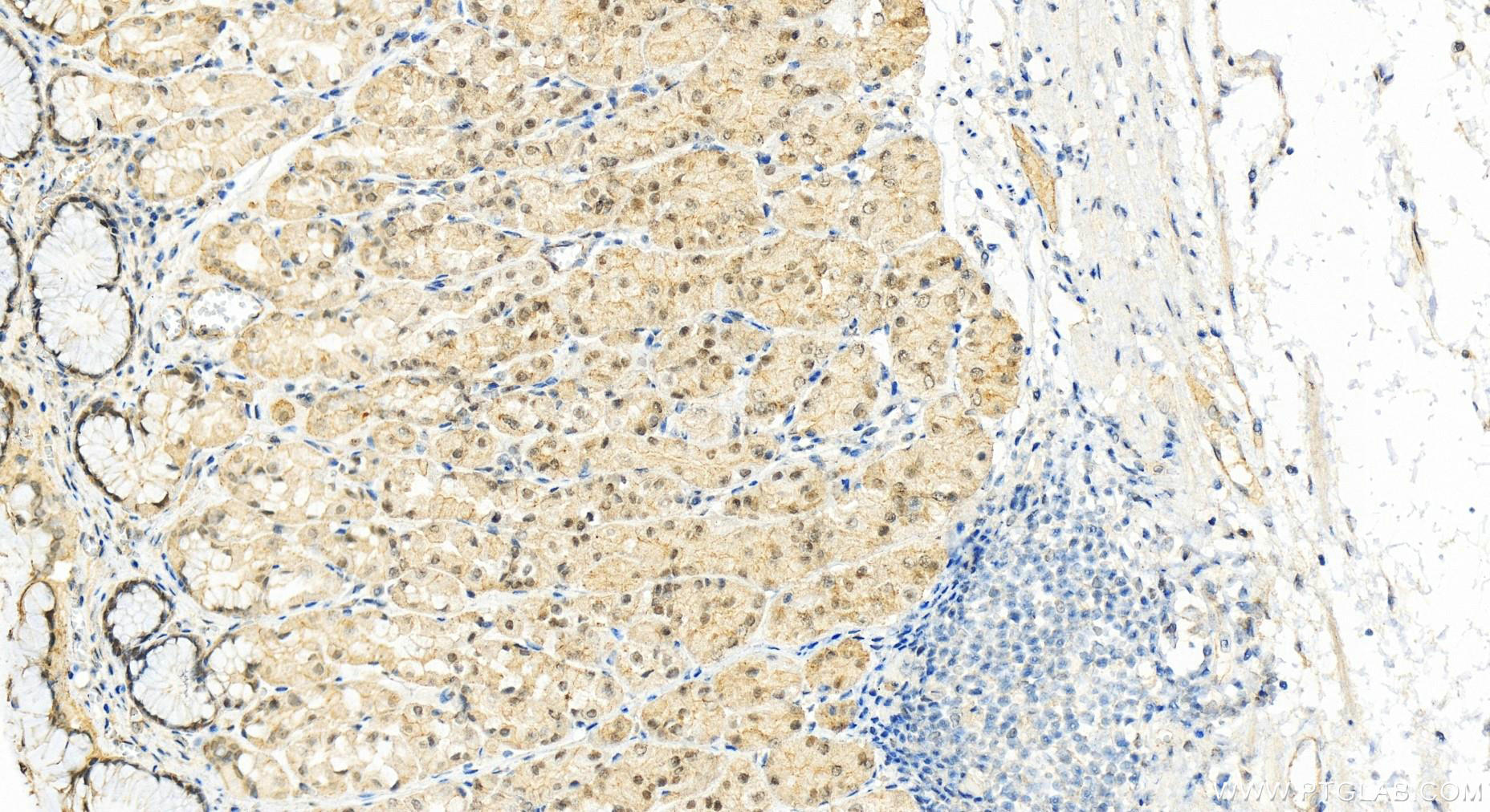 IHC staining of human stomach using 14185-1-AP