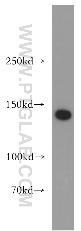 WB analysis of HeLa using 14185-1-AP