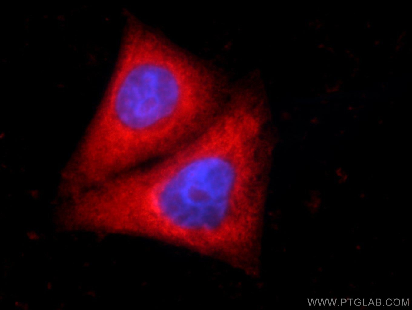 IF Staining of HepG2 using 24758-1-AP