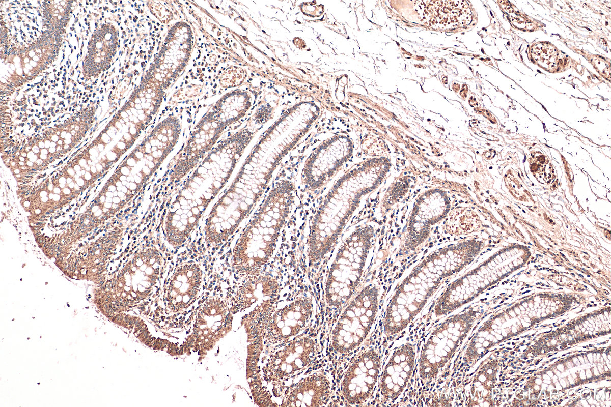 IHC staining of human colon using 24758-1-AP