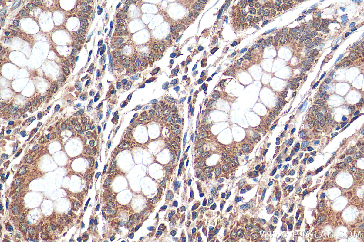 IHC staining of human colon using 24758-1-AP