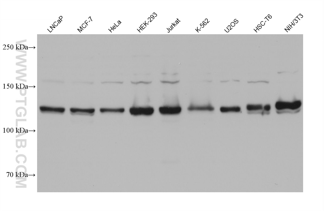 WB analysis using 68655-1-Ig (same clone as 68655-1-PBS)