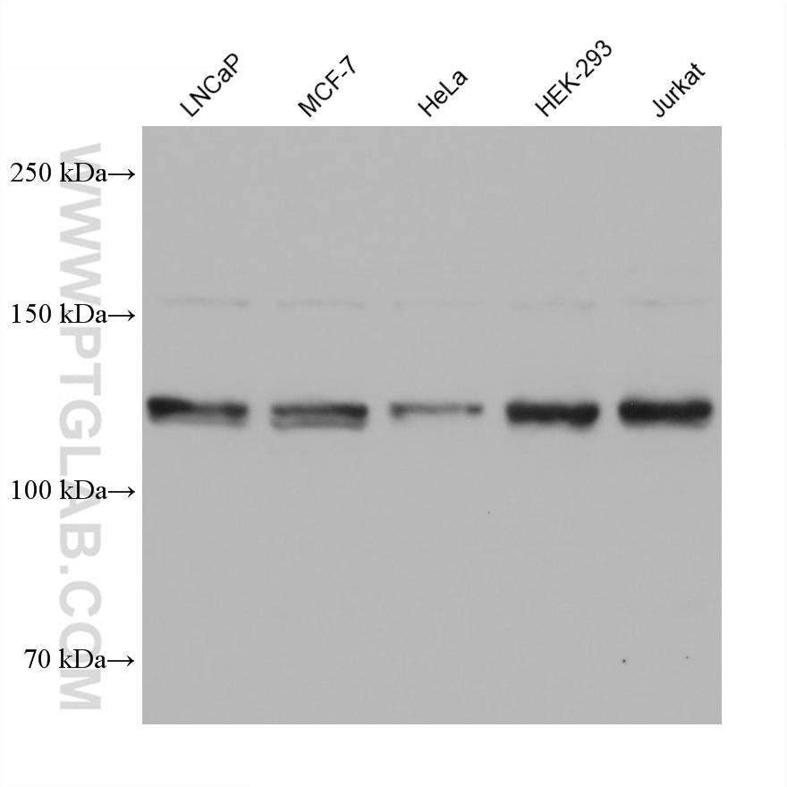 WB analysis using 68655-1-Ig (same clone as 68655-1-PBS)