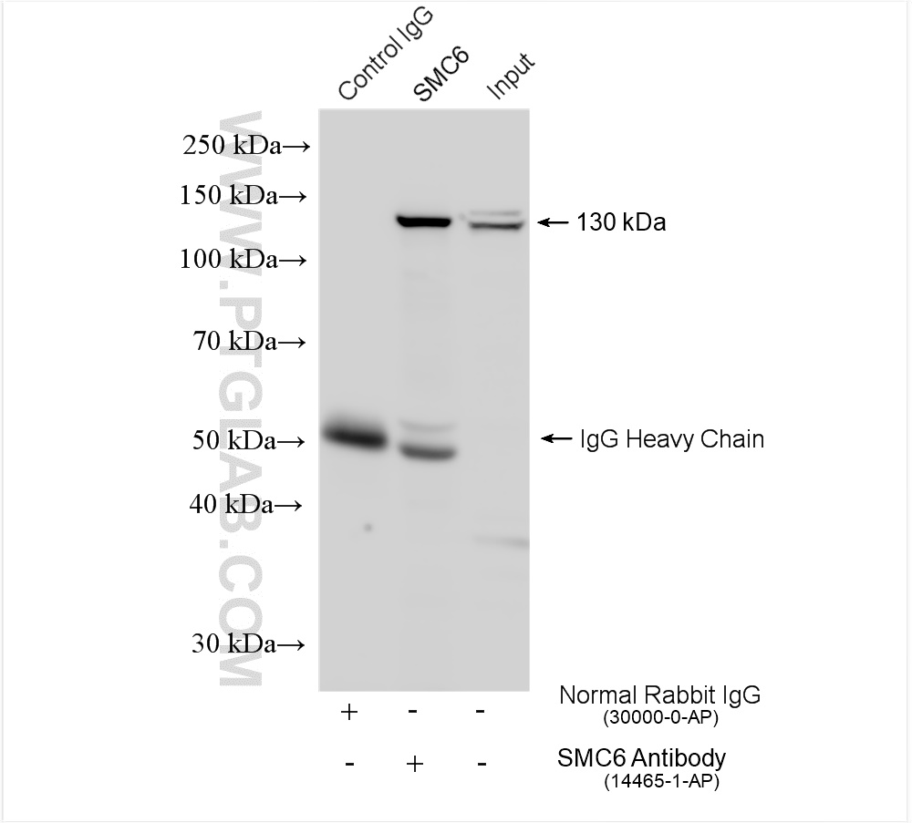 IP experiment of HeLa using 14465-1-AP (same clone as 14465-1-PBS)