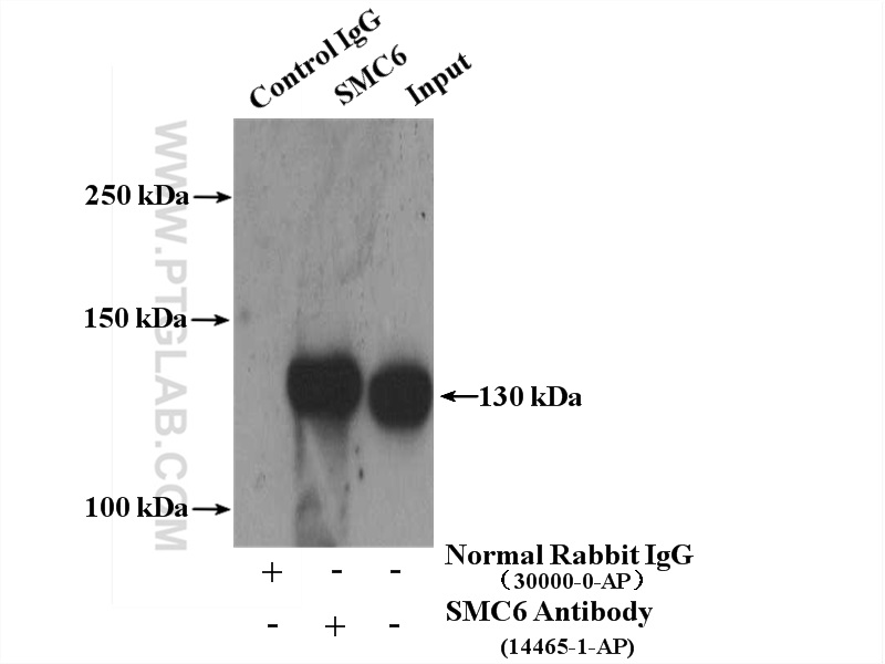 IP experiment of mouse testis using 14465-1-AP (same clone as 14465-1-PBS)