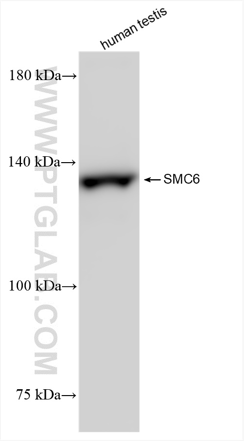 WB analysis of human testis using 83187-3-RR