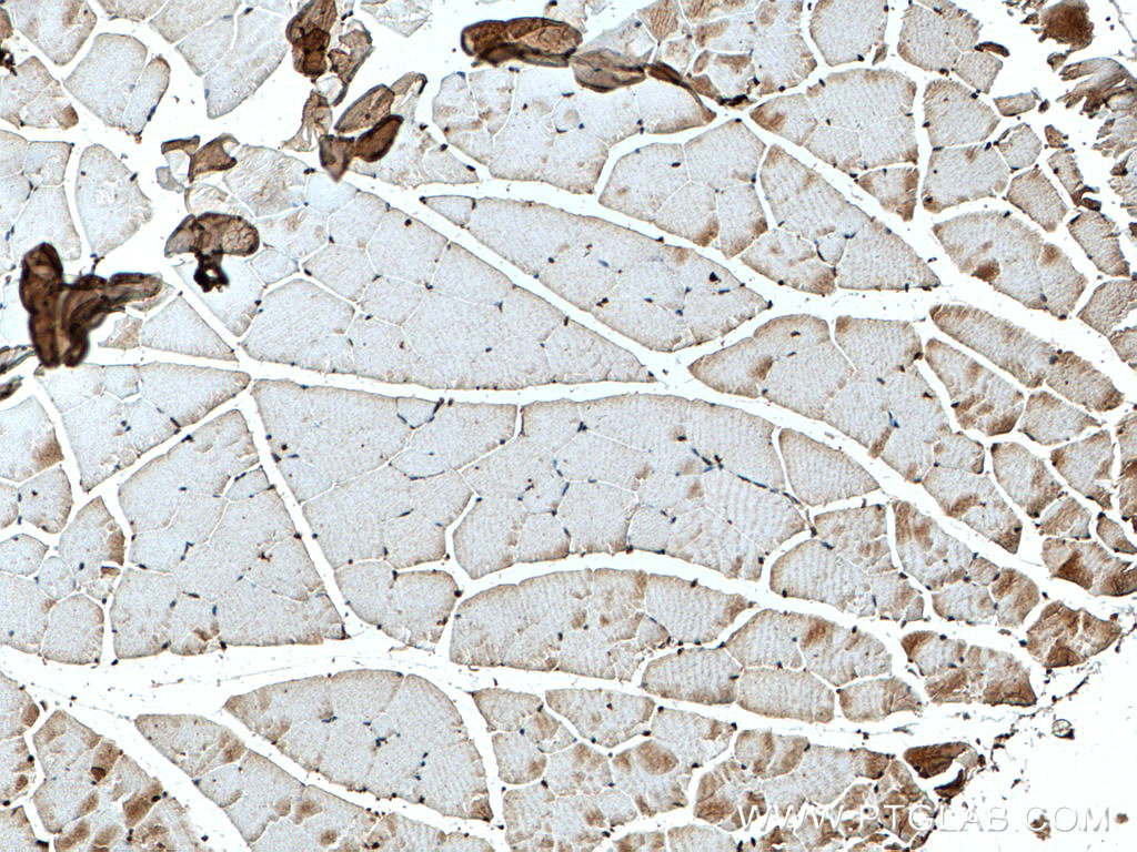 IHC staining of mouse skeletal muscle using 25589-1-AP