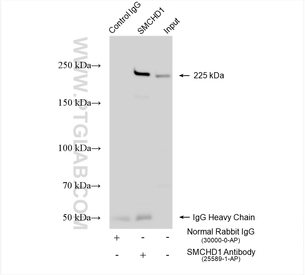 IP experiment of HeLa using 25589-1-AP