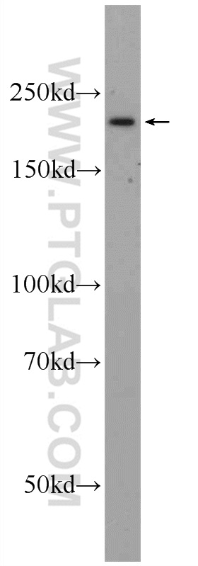 WB analysis of HeLa using 25589-1-AP