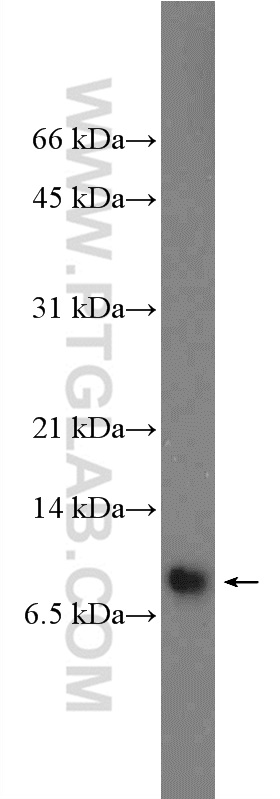 WB analysis of HEK-293 using 25815-1-AP