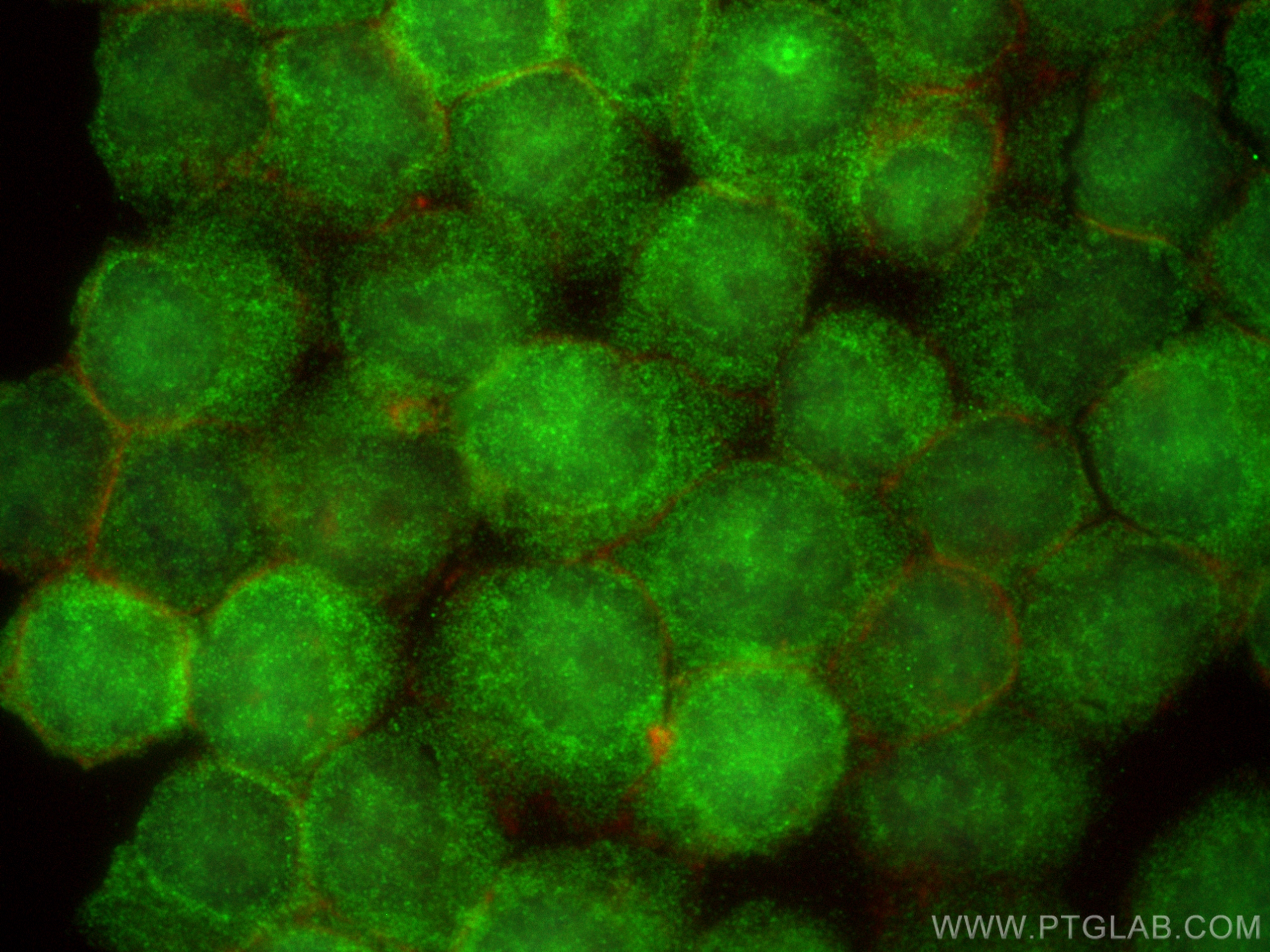 IF Staining of Jurkat using 12694-1-AP