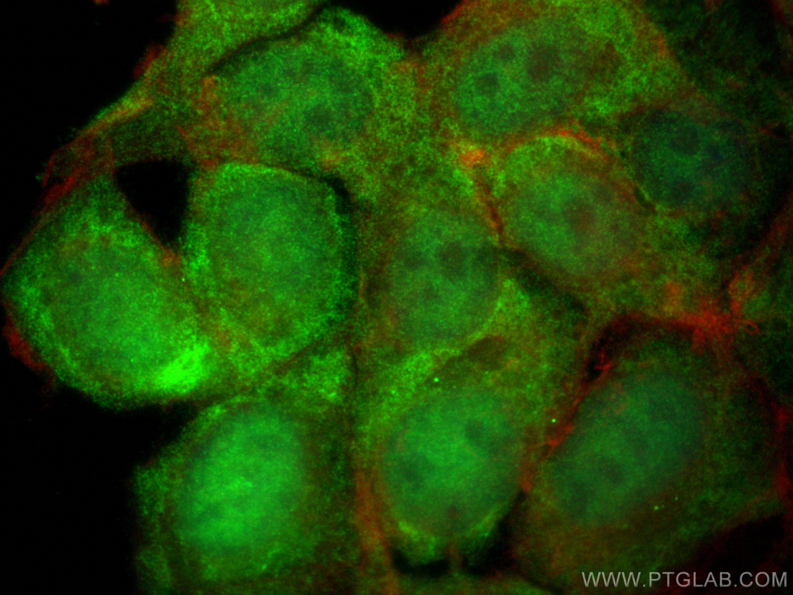 IF Staining of MCF-7 using 12694-1-AP