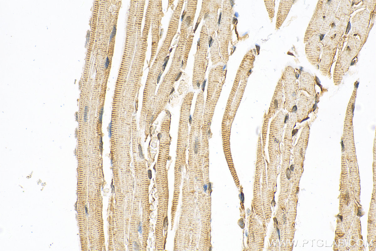 IHC staining of mouse heart using 12694-1-AP