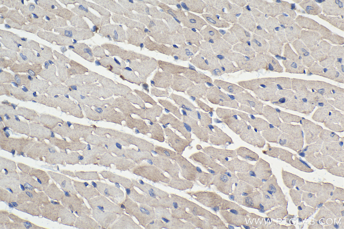 IHC staining of mouse heart using 60255-1-Ig