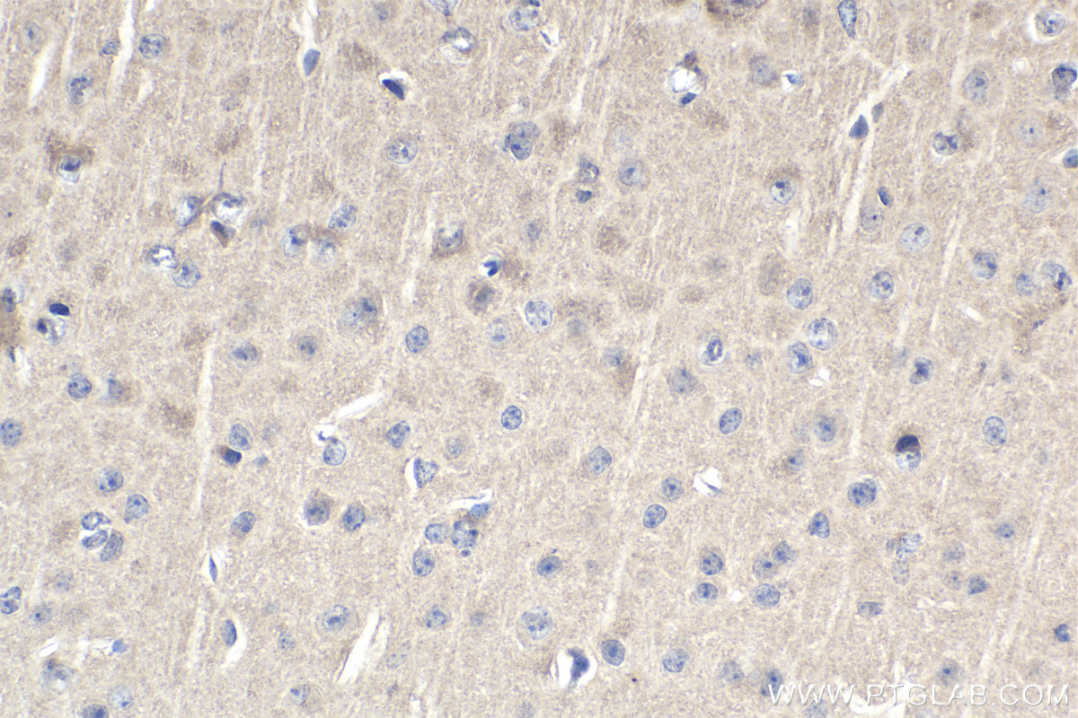 IHC staining of mouse brain using 60255-1-Ig