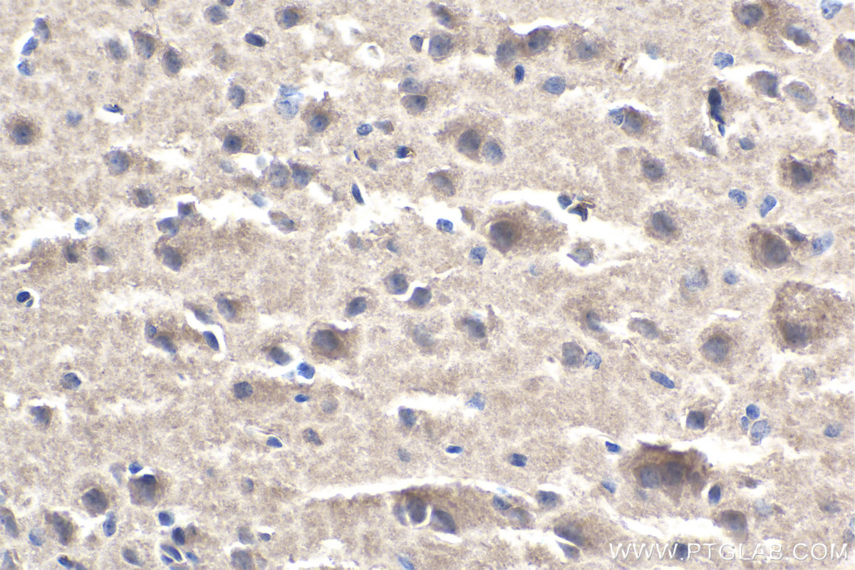 IHC staining of rat brain using 60255-1-Ig (same clone as 60255-1-PBS)