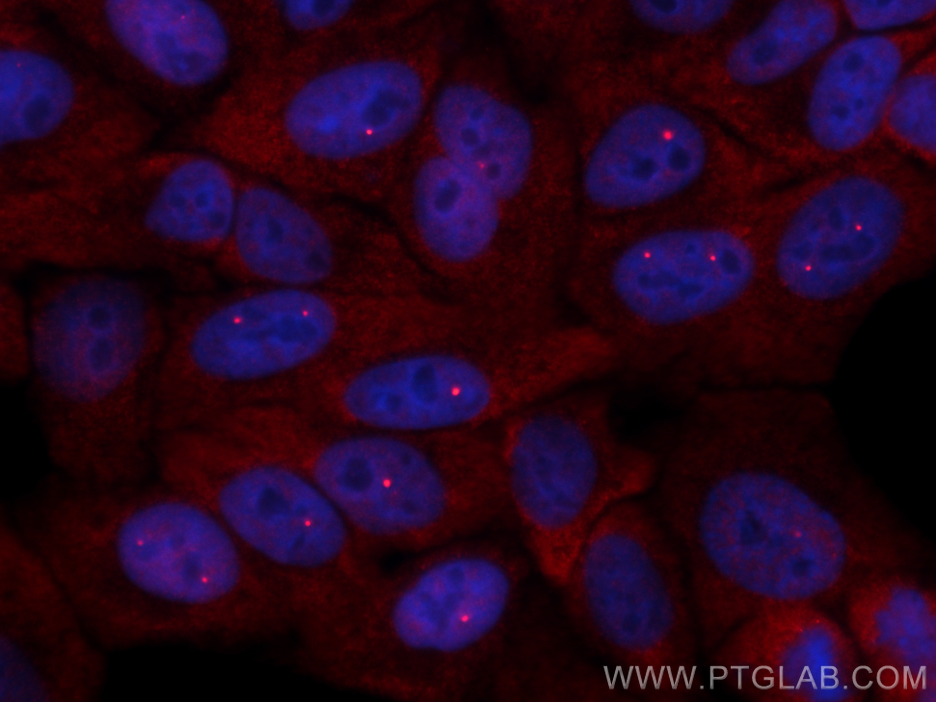 IF Staining of HepG2 using 11708-1-AP