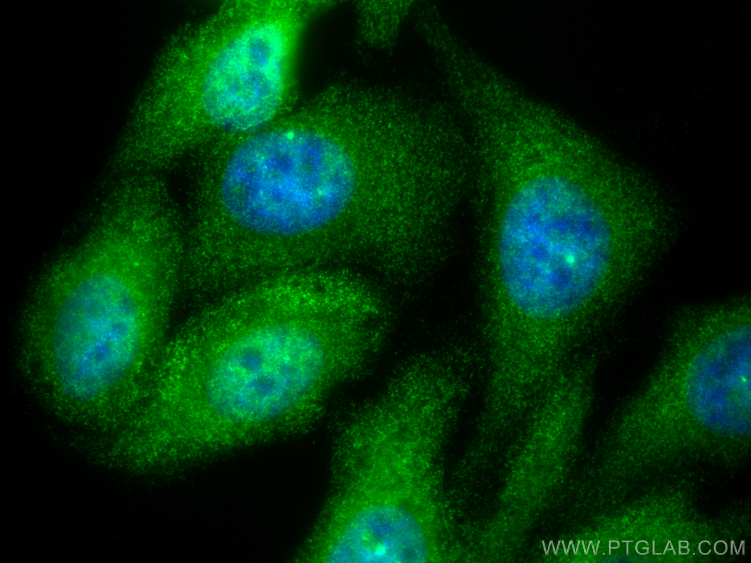 IF Staining of HepG2 using 60154-1-Ig