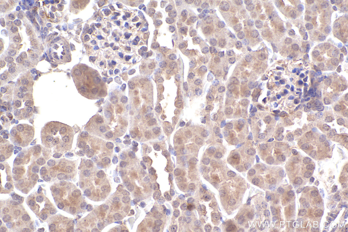 IHC staining of mouse kidney using 60154-2-Ig (same clone as 60154-2-PBS)