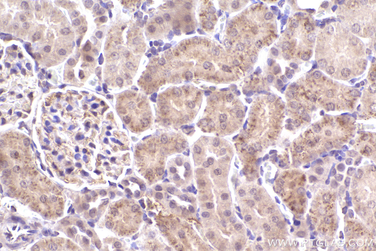 IHC staining of rat kidney using 60154-2-Ig (same clone as 60154-2-PBS)