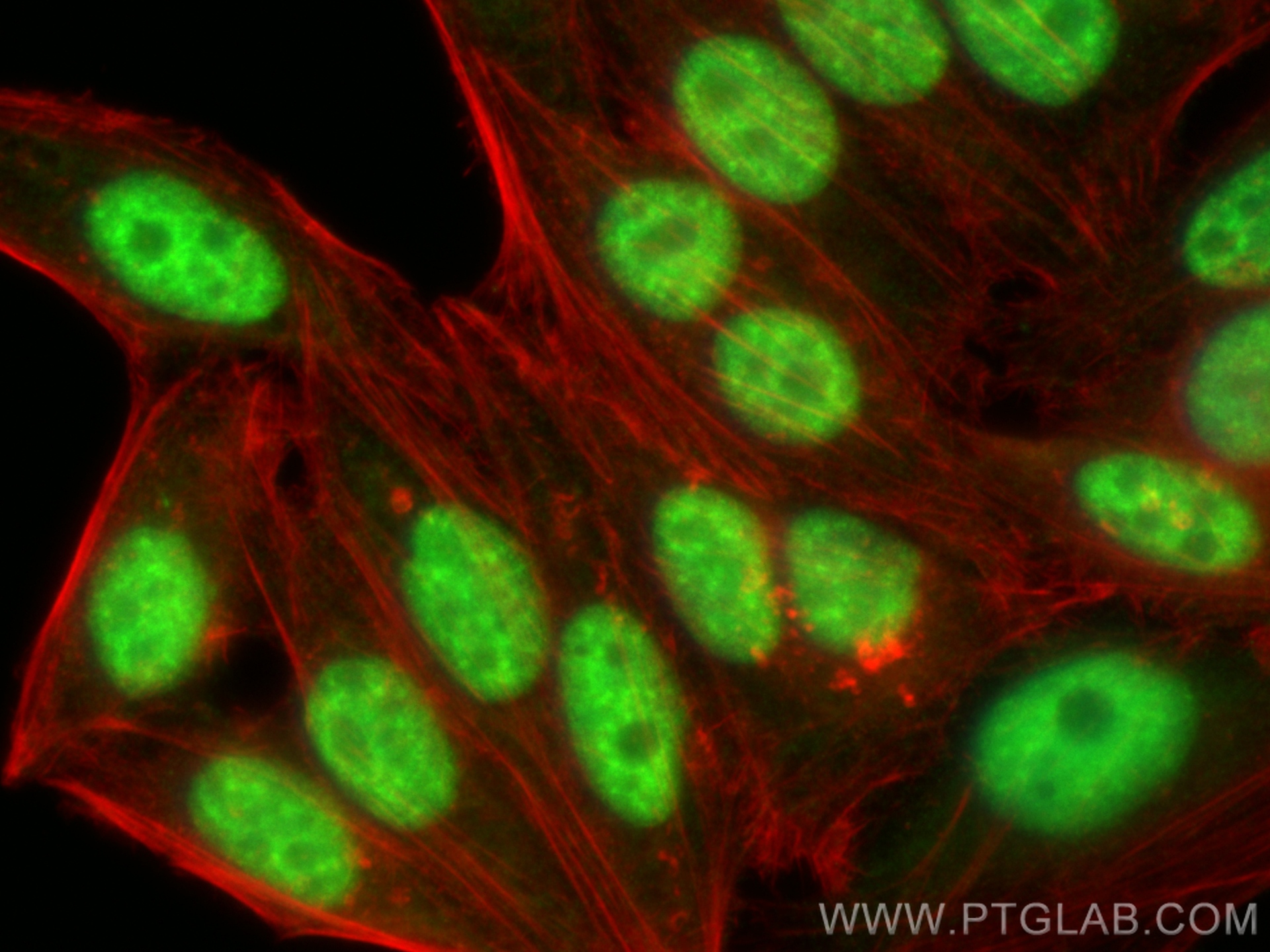 IF Staining of HepG2 using 12178-1-AP