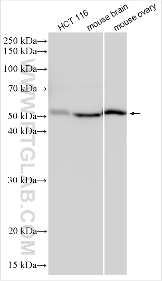 WB analysis using 31063-1-AP