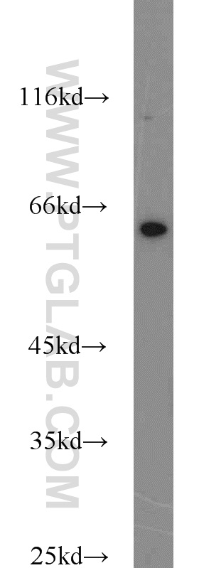 WB analysis of PC-13 using 15052-1-AP