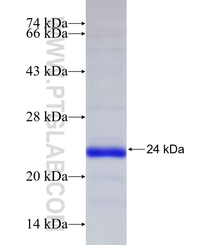 SMPD1,ASM fusion protein Ag32479 SDS-PAGE