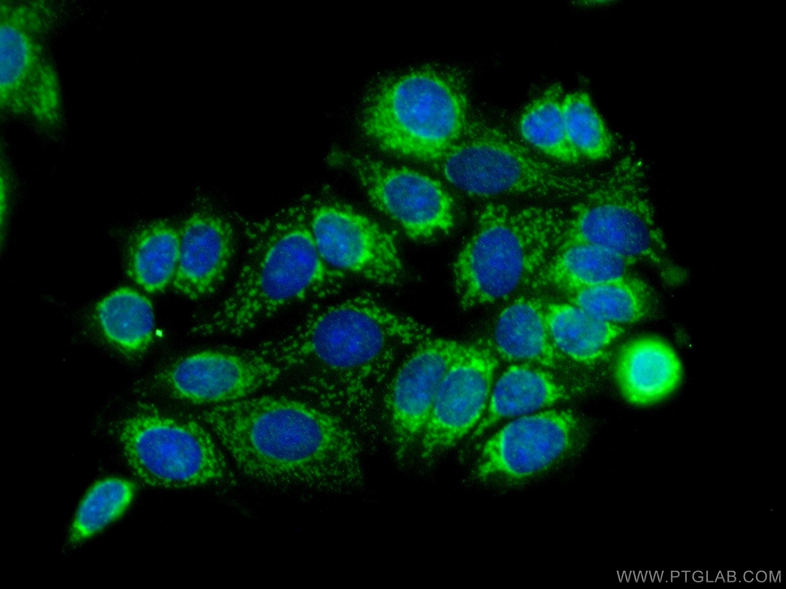 IF Staining of MCF-7 using 14782-1-AP