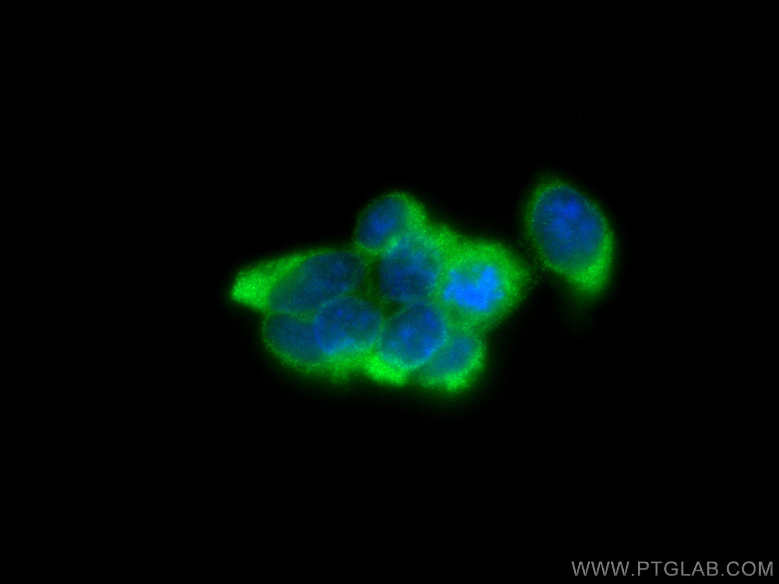 IF Staining of HEK-293 using 12011-1-AP